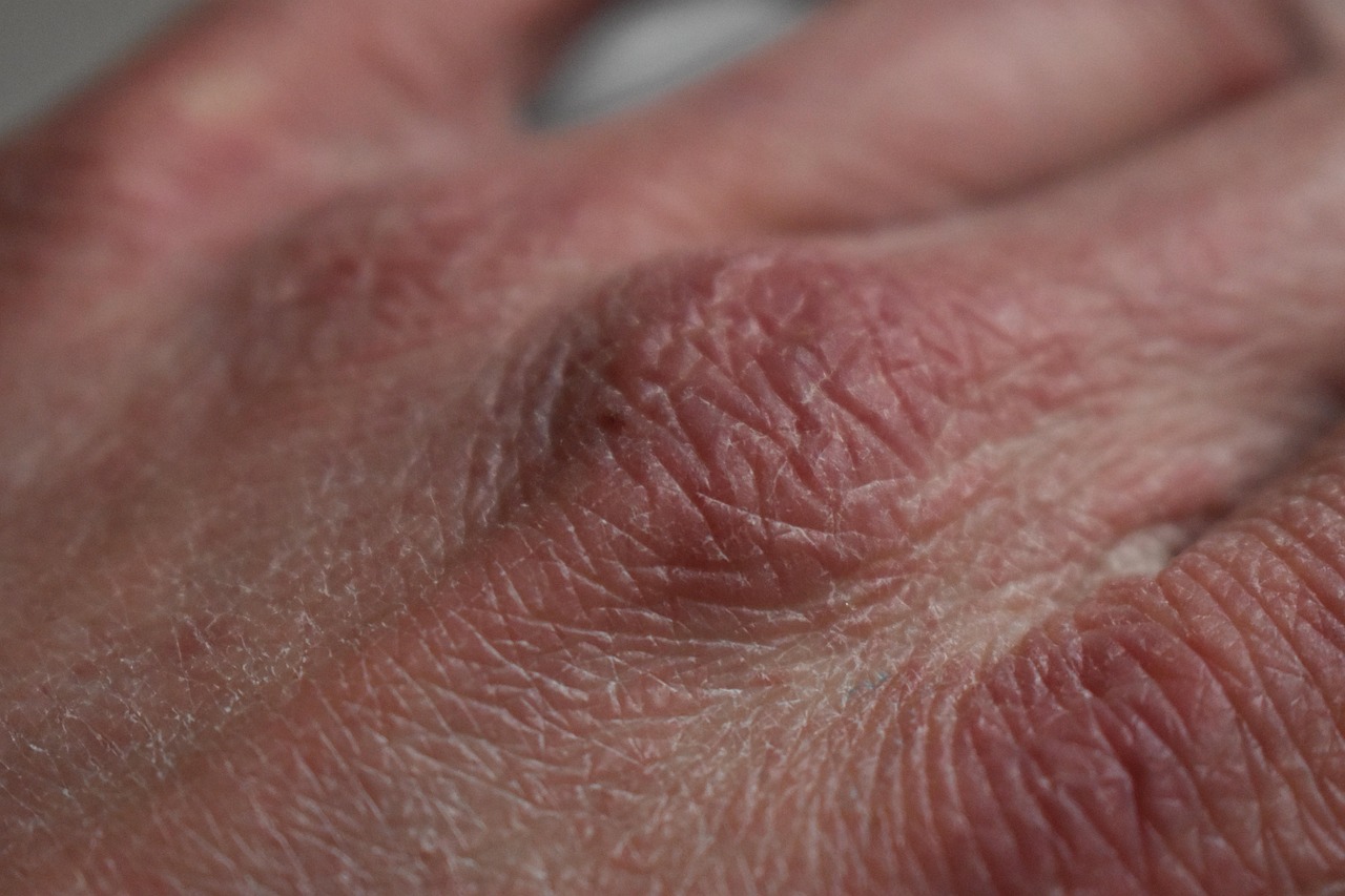 Come migliorare l'elasticità della pelle secca con TattooVel